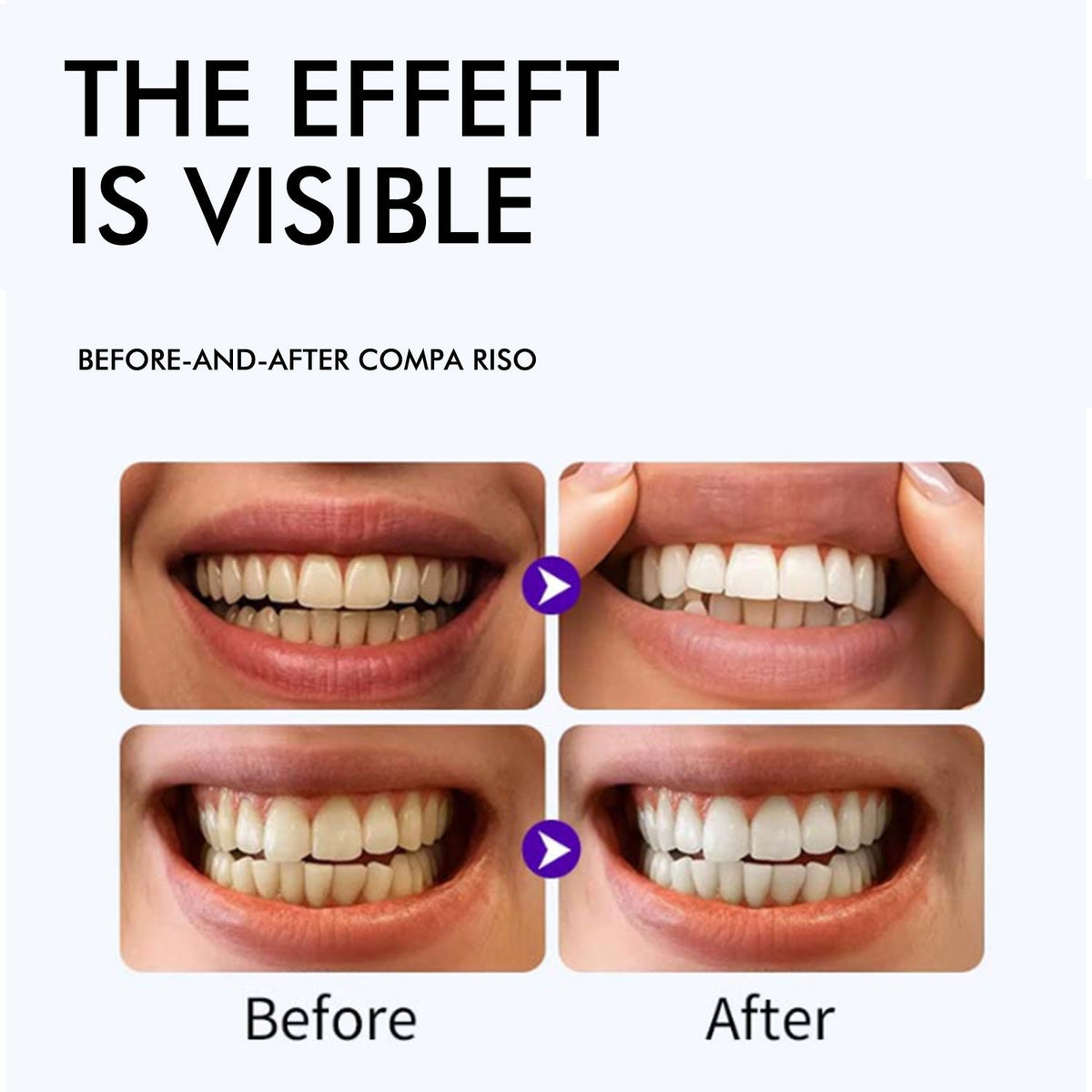 Purple Whitening Strips