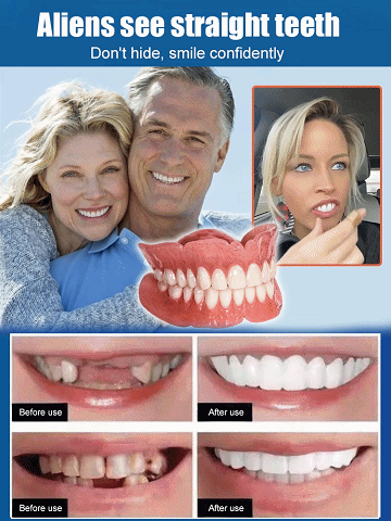 🔥【Finally! Dentures That Let You Eat Apples & Nuts】Perfect Smile Dentures