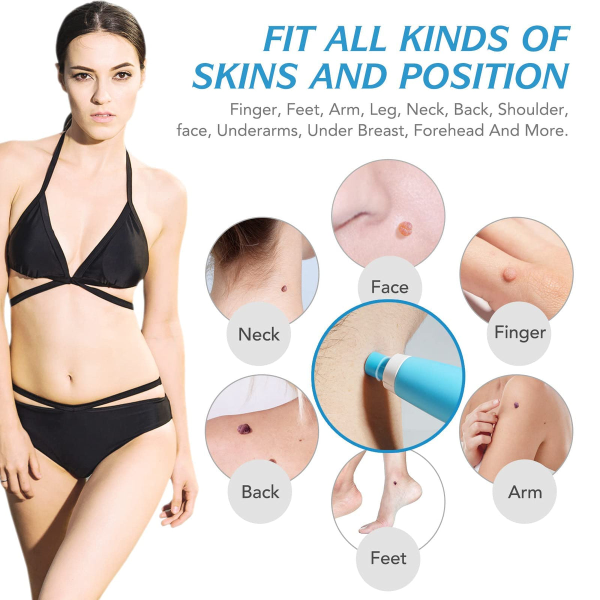 Auto Skin Tag Remover Kit for Face & Body